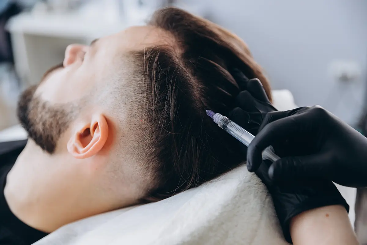 DHI-Hair-Transplant-in-Turkey---The-Ultimate-Guide