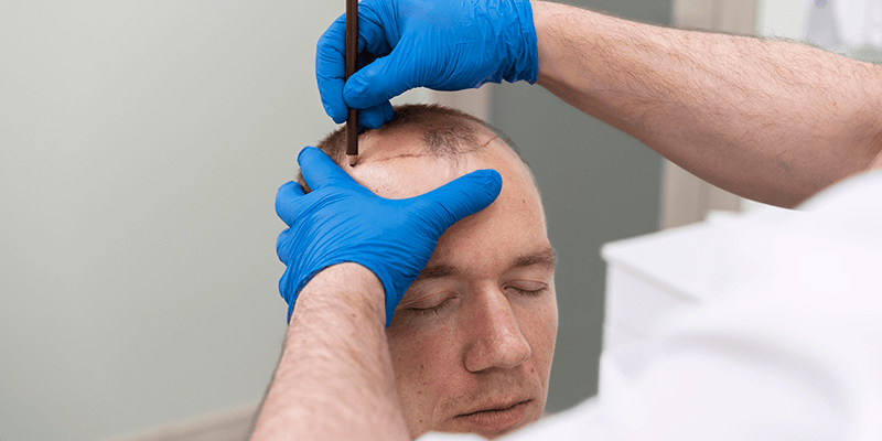 How Does Micrografting Work