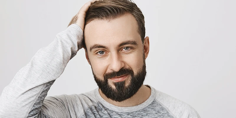 Recovery and Results After a 4000 Grafts Hair Transplant