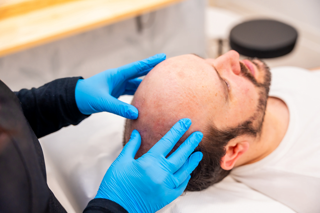 What-is-the-Ideal-Age-for-a-Hair-Transplant--A-Comprehensive-Guide