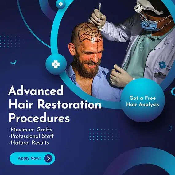 Advanced Hair Restoration in Turkey 10 lenus clinic 2 1 1 1